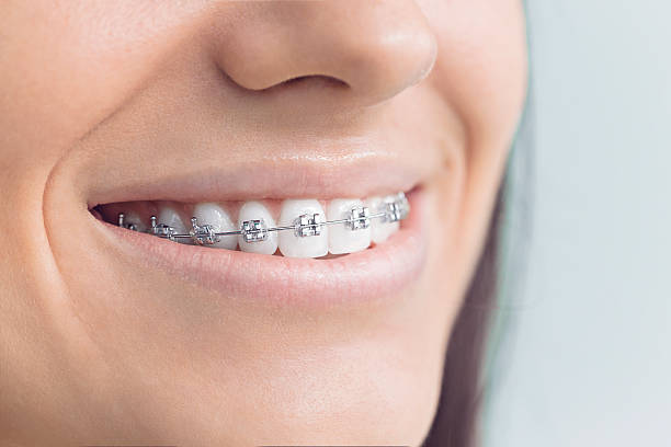 Best Teeth Whitening  in Youngstown, NY